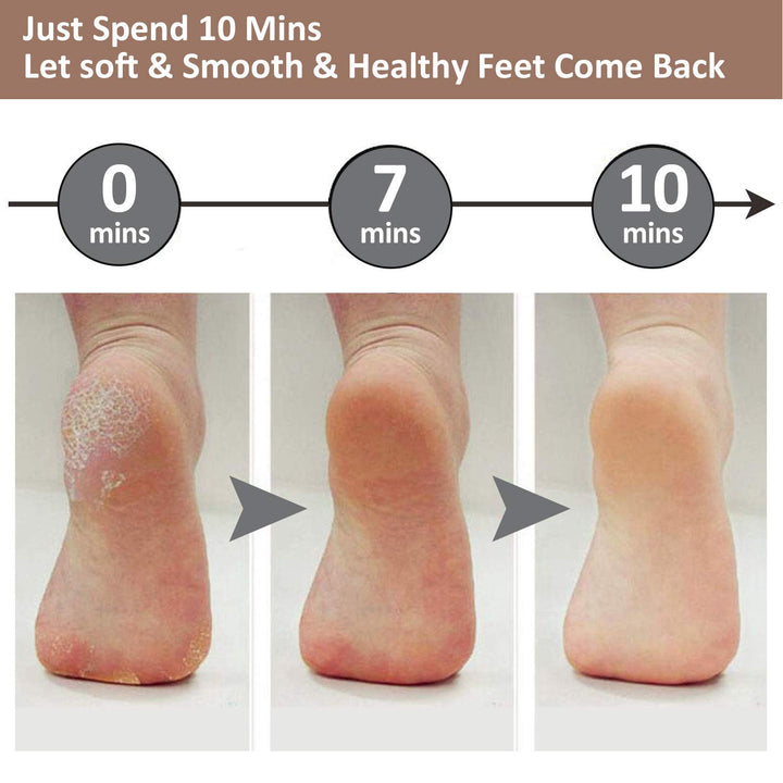Electric Foot Pedicure Machine - DHACTIVE 7